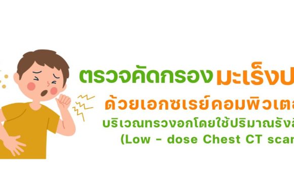 โปรแกรมตรวจคัดกรองมะเร็งปอดด้วยเอกซเรย์คอมพิวเตอร์(Low dose CT scan, LDCT)